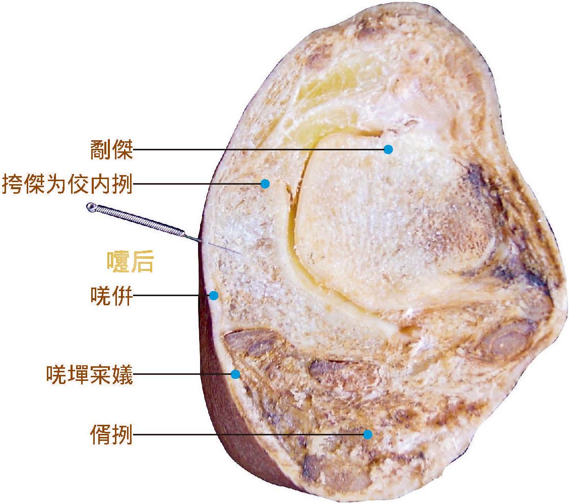 申脈